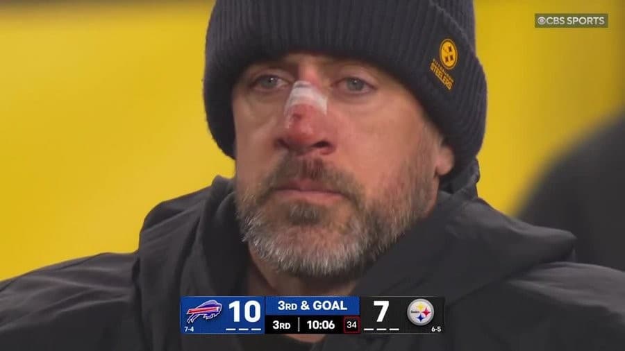Aaron Rodgers Bloody Nose Reaction