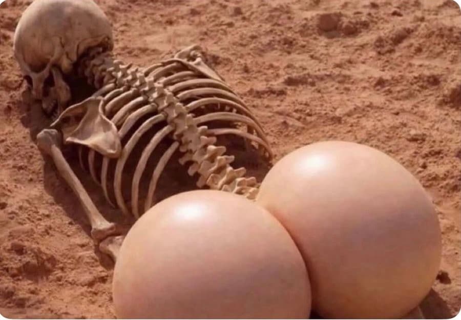A human skeleton lies partially buried in reddish sand, with two enormous smooth flesh-colored spherical implants positioned behind its pelvis.