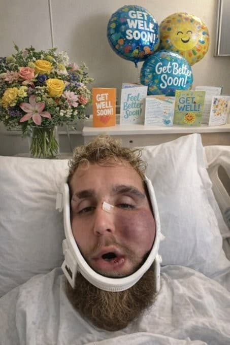 Jake Paul in a hospital bed