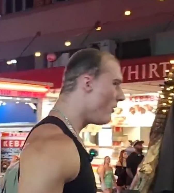 Kick streamer Androgenic hairline meme template