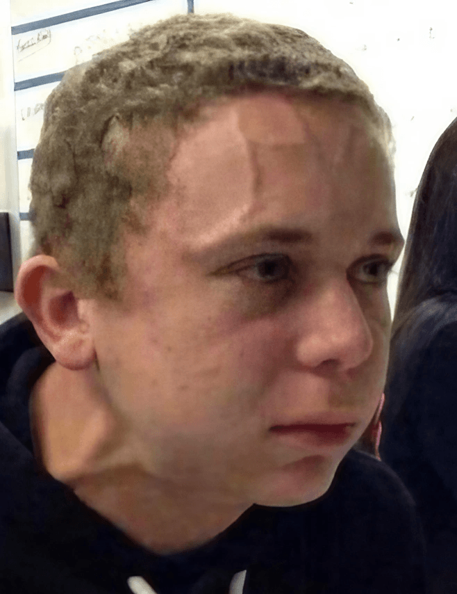 Neck Vein Guy Meme Template