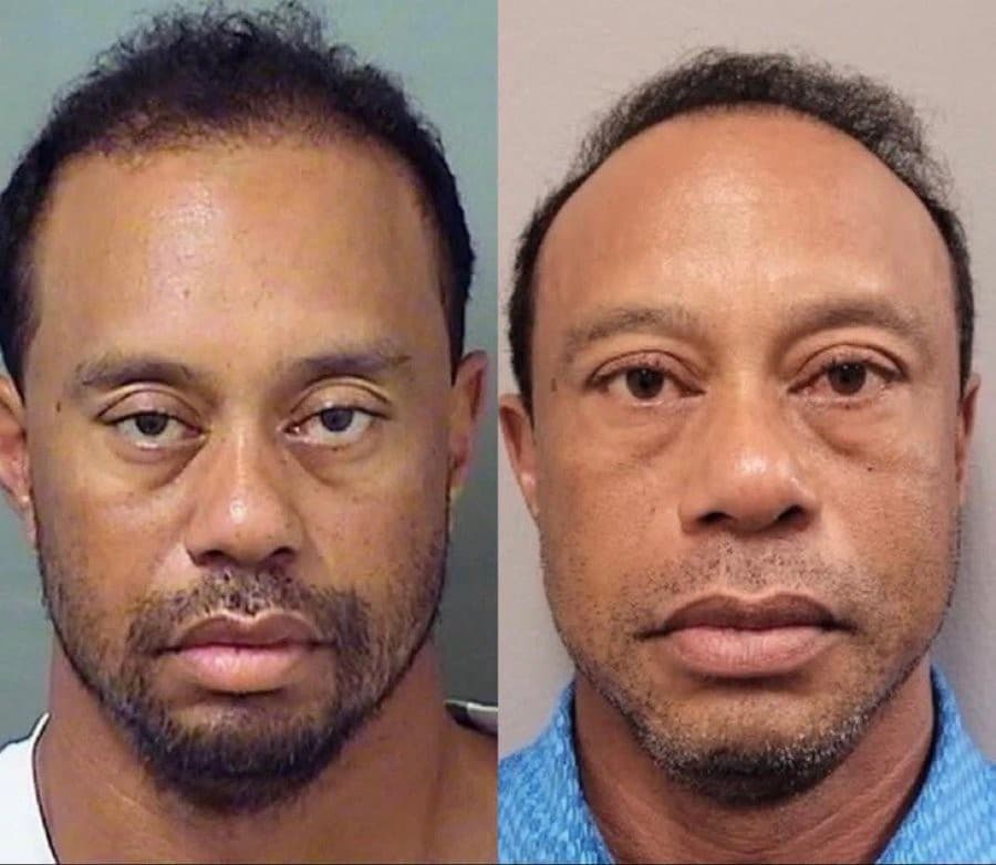Tiger Woods Mugshot 2017 and 2026
