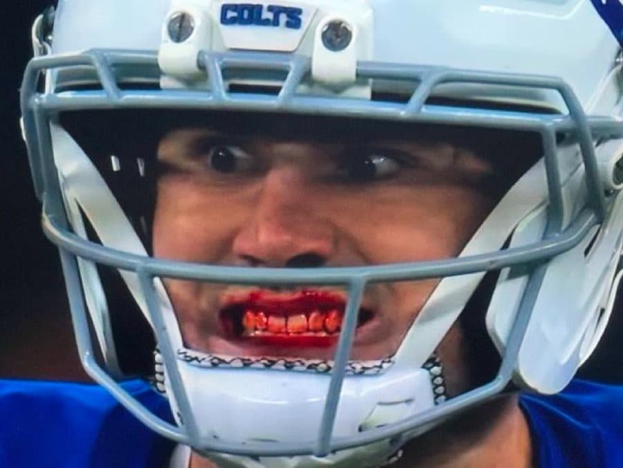 Daniel Jones bloody facial injury NFL meme template