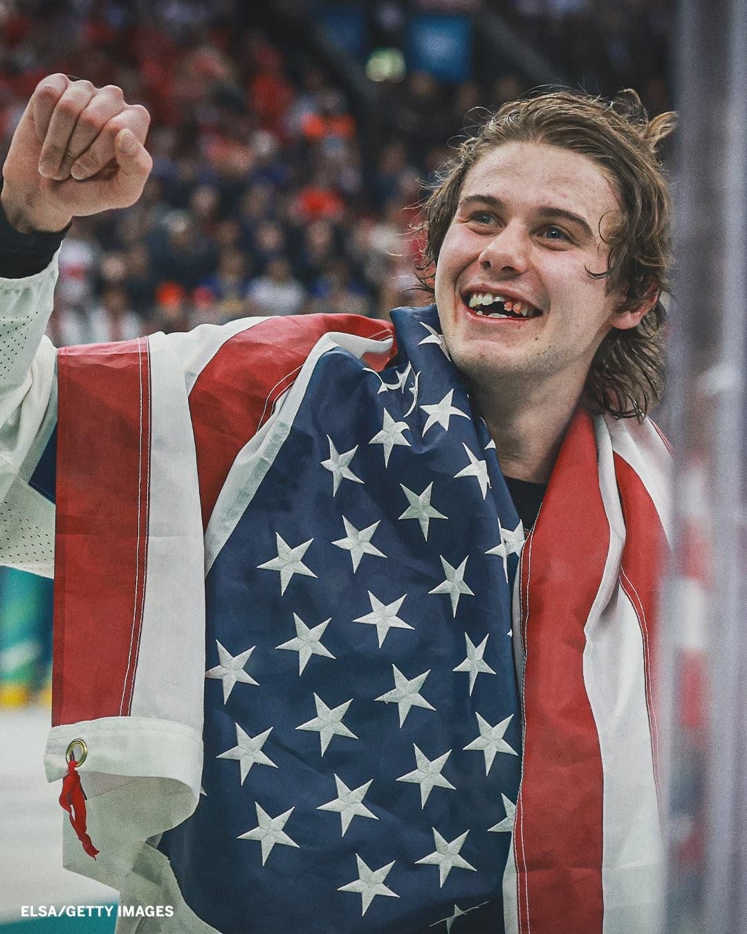 Jack Hughes Missing Two Front Teeth Celebration USA Hockey Gold