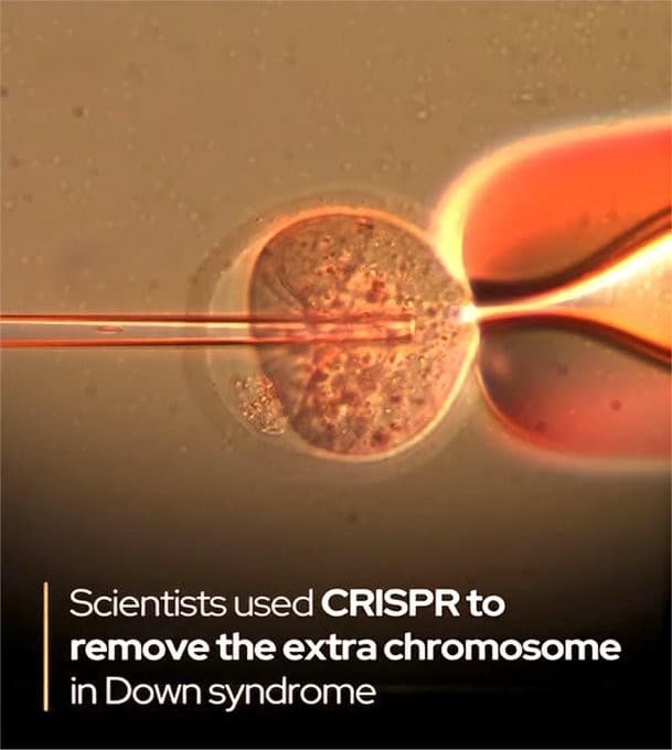 Japan scientists used CRISPR to remove the extra chromosome in Down syndrome meme template